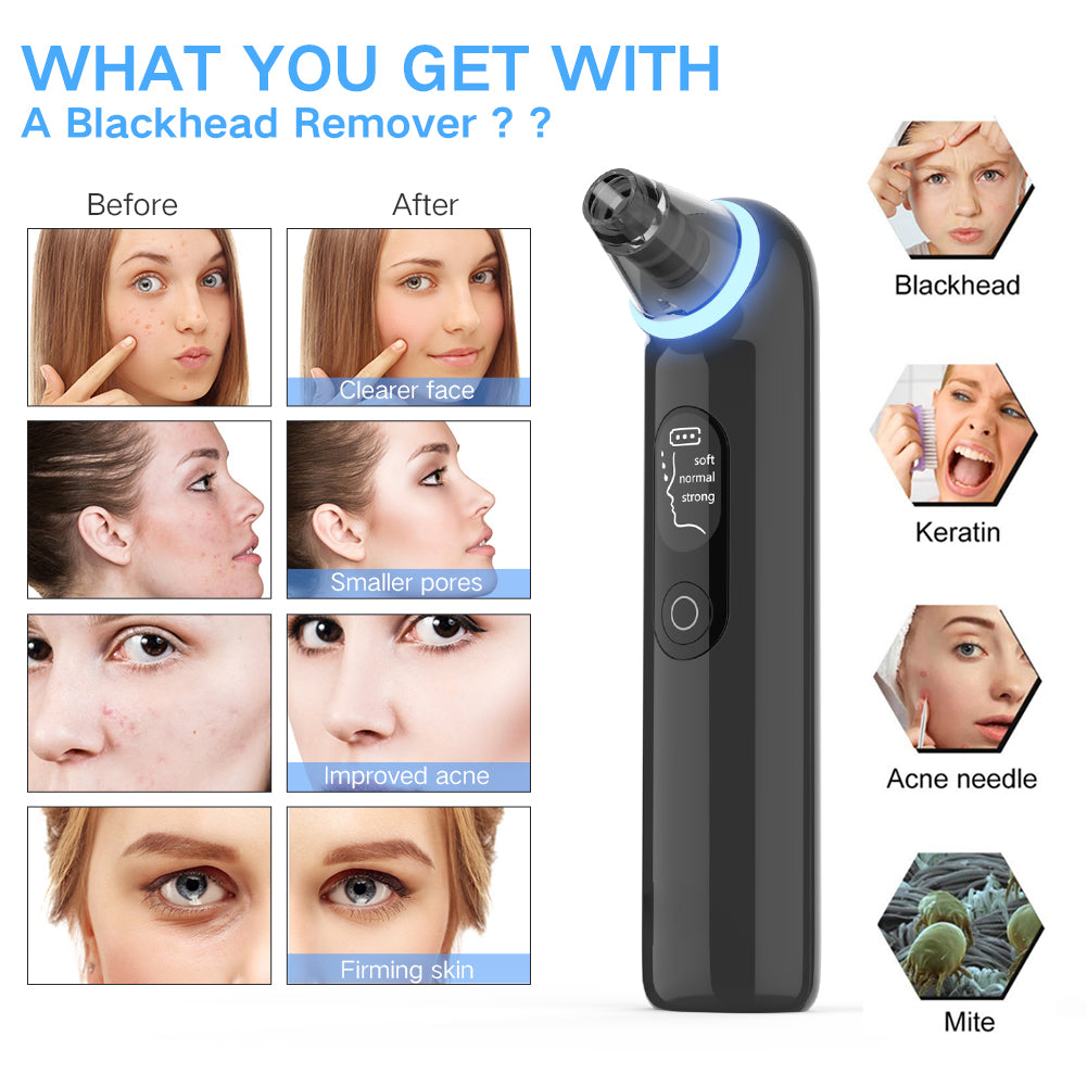 Blackhead Remover Vacuum