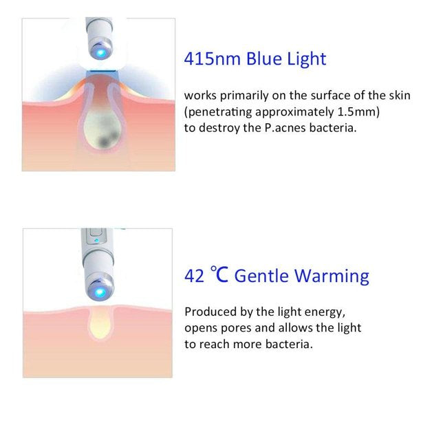 Blue Light Pen For Spider Veins,Acne Laser Pen,Soft Scar Wrinkle,Puffy Eyes Dark Circles Removal