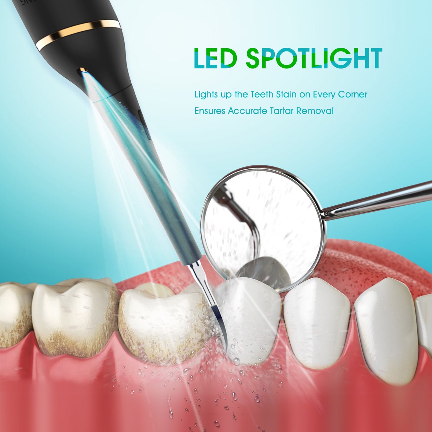 iFanze Dental Calculus Tartar Remover