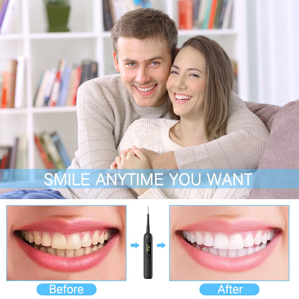 Electric Sonic Dental Calculus Plaque Remover Tools Kit, Tooth Scraper Tartar Removal Cleaner, Teeth Stain Eraser Polisher