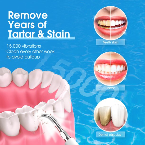 Sonic Plaque Remover for Teeth, Ifanze Electric Dental Calculus Remover Tool with 4 Toothbrush Heads, Tartar Cleaner Kit with 4 Cleaning Heads, Safe for Adult Kids