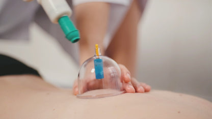 Cupping Set, 24 Cups Professional Chinese Acupoint Cupping Therapy Sets, Hijama Cupping Set with Pump Vacuum Suction Cups for Body Cellulite Cupping Massage Back Pain Relief