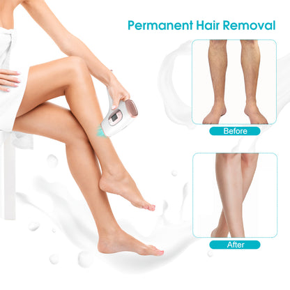 Laser Hair Removal for Women