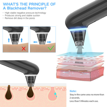 Blackhead Remover Vacuum