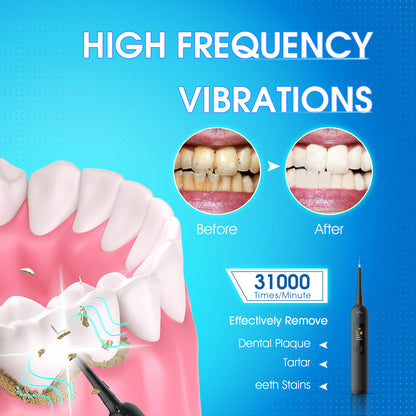 iFanze Electric Dental Calculus Remover