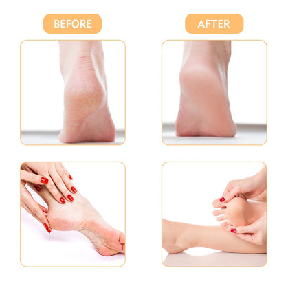Electric Callus Remover, Rechargeable Foot File Hard Skin Remover Pedicure Tools for Feet Electronic Callus Shaver Waterproof Pedicure kit for Cracked Heels and Dead Skin with 2 Roller Heads