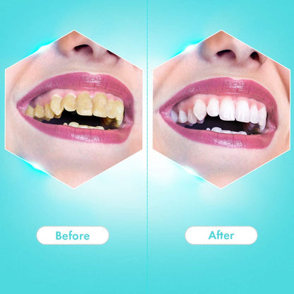 Plaque Remover for Teeth, Ultrasonic Tooth Cleaner Tartar Remover, Electric Teeth Cleaning Kit Tooth Stain Calculus Remover 2 in 1 Toothbrush Cleaning, Safe for Adult and Kids，Dental Calculus，calculus teeth，dental plaque，snow teeth whitening