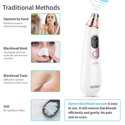 Xpreen Blackhead Remover Vacuum, Xpreen Pore Vacuum with Blue Light, Pore Cleaner Vacuum USB Rechargeable, Pore Vacuum Blackhead Remover with LED Screen for Women Men Face Nose (White)