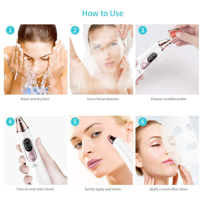 Blackhead Remover Pore Vacuum