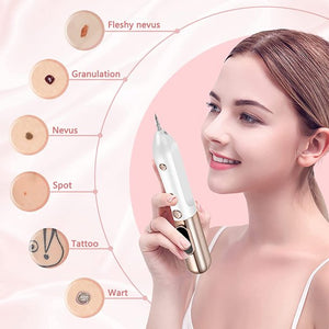 Skin Tag Remover, 9 Level Adjustable Mole Remover Pen with USB Charging and 20 Replaceable Needles, Home Usage, White