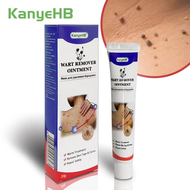 Wart Remover Cream, Wart Removal and Skin Tag Removal Treatment Ointment Herbal Extract Corn Calluses Plaster Wart Ointment Body Care, 1PCS
