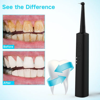 Xpreen Electric Calculus Plaque Remover for Teeth, Xpreen USB Rechargeable Sonic Dental Tartar Scraper Tooth Stains Whiten Tool Kit for Kids Adult