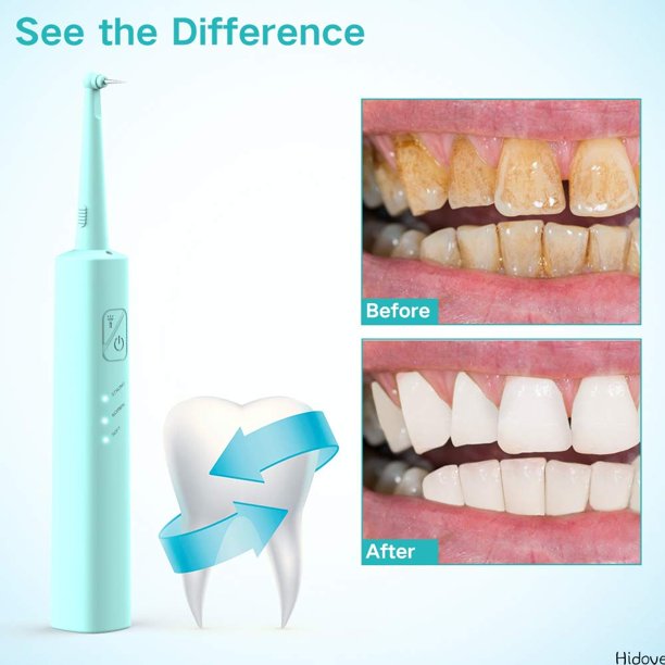 Teeth Calculus Remover, Dental Tools Teeth Stain Remover, Dental Calculus Remover,Electric Tartar Scraper Plaque Remover Dental Cleaner with 2 Replaceable Clean Heads