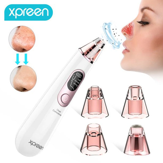 Xpreen Blackhead Remover Vacuum, Facial Pore Sucker, Electric Blackhead Vacuum Cleaners, Whitehead Blackhead Removal Tool for Men and Women, White