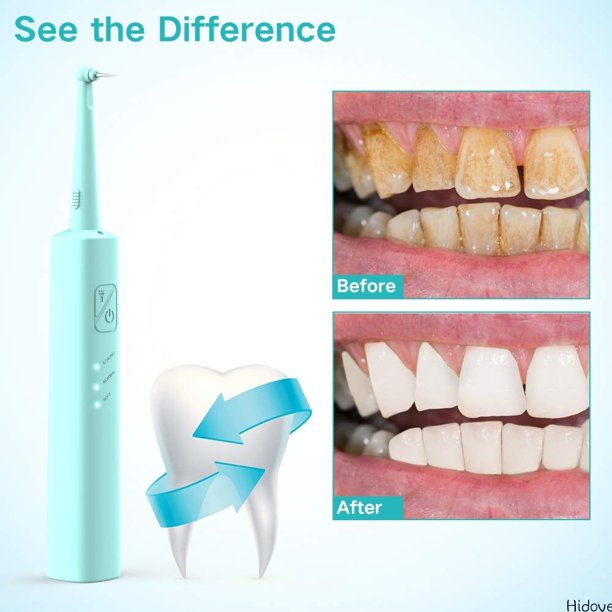 Electric Dental Calculus Remover, iFanze Plaque Remover for Teeth Teeth Cleaner Tooth Tartar Scraper with 6 Replaceable Clean Heads