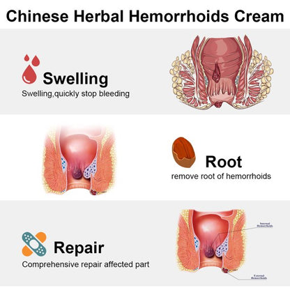 vinsic Dictamni Hemorrhoids, Natural Herbal Anal Cream, Hemorrhoid Pain Relief Products